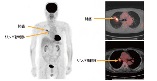 コレクション ペット 検査 確率